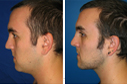 Before & After Photos